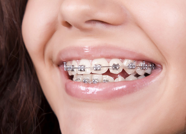 ORTHODONTICS-TREATMENT