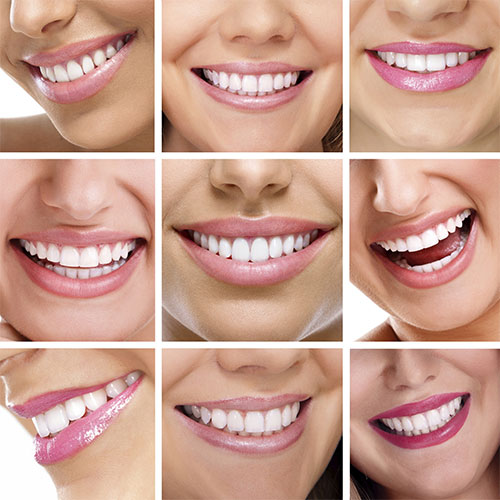 SMILE-MAKEOVER-SMILE-DESIGNING-SMILE-ANALYSIS